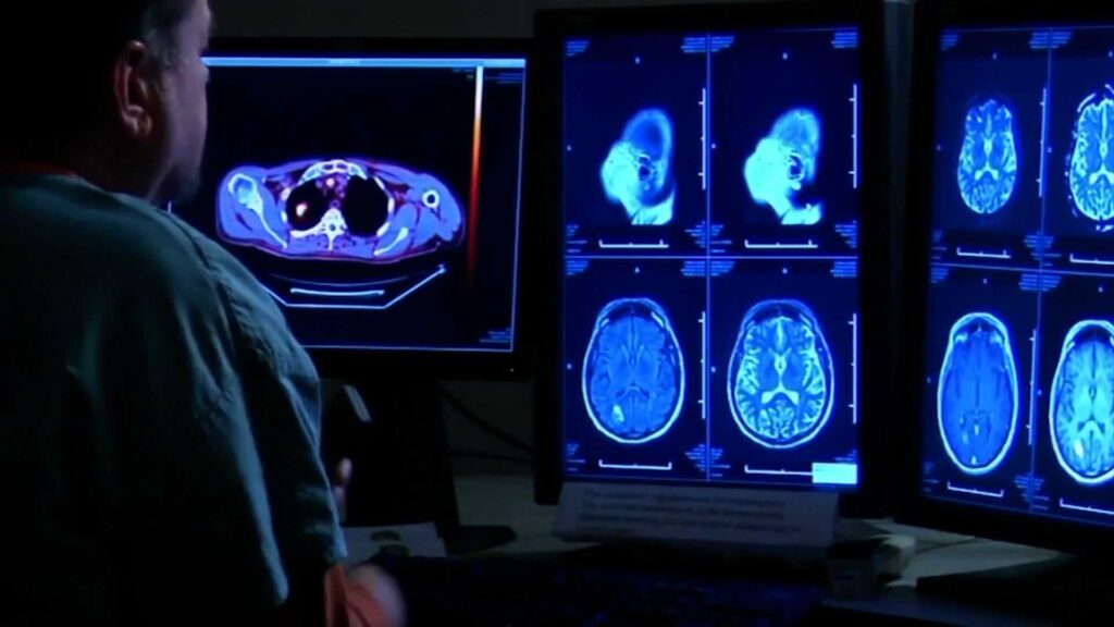 looking-at-brain-imaging-65c2bdb4a1130