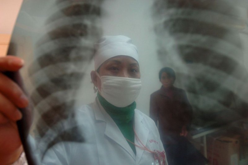 Death-toll-from-New-York-Legionnaires-disease-outbreak-rises-to-3