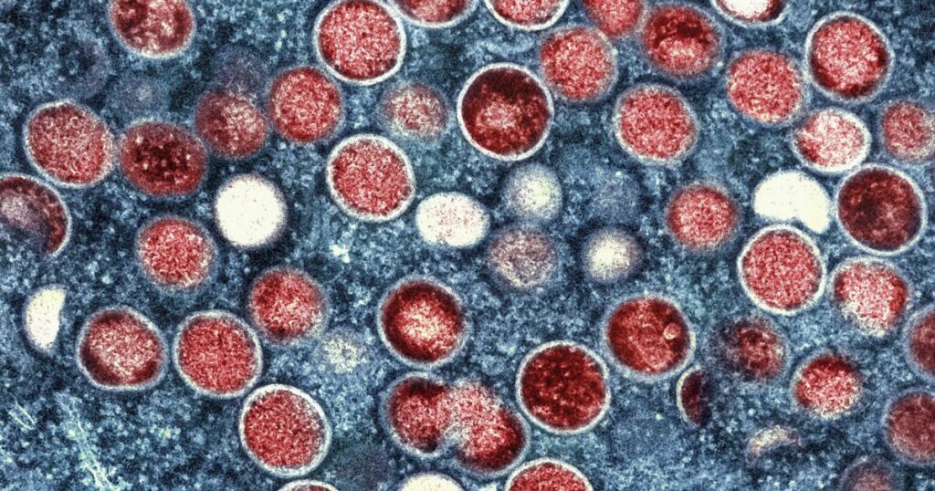 url-https-california-times-brightspot-s3-amazonaws-com-6b-4e-5c47942a4f549a5e499a32de5a81-mpox-71232