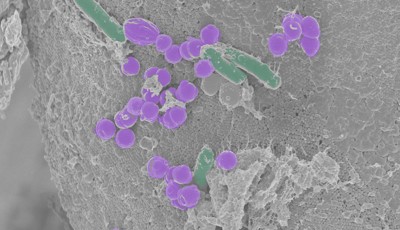 image-php-image-images-uploads-2026-02-26-69a0a449616c3-Microbiome-PROMO