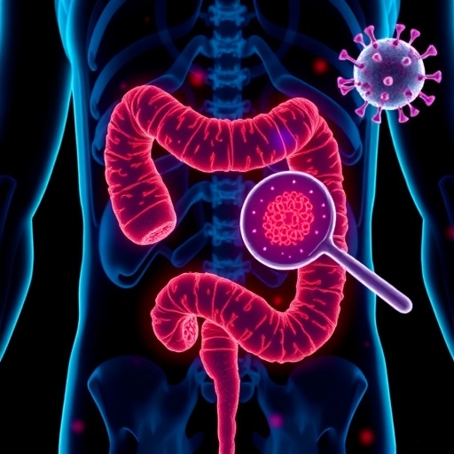 newly-identified-virus-associated-with-colorectal-cancer-uncovered