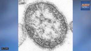 measles-1-300x169