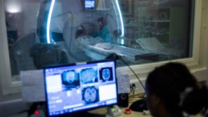 alzheimers-disease