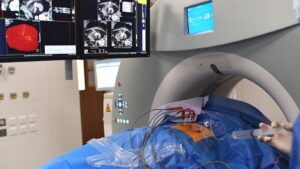 kidney-failure